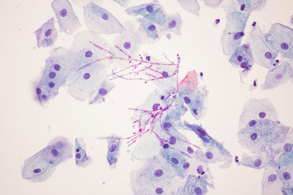 CANDIDA IM DARM? MACH DEN TEST