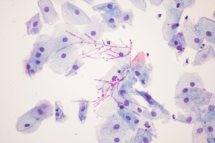 CANDIDA IM DARM? MACH DEN TEST
