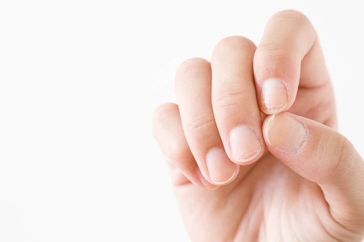 KRÄFTIGE FINGERNÄGEL: DIE BESTEN TIPPS