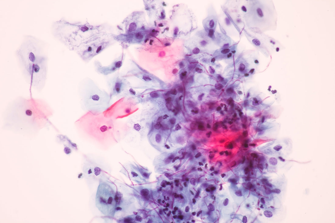 DARMPILZ (CANDIDA) VERTREIBEN: 3 TIPPS