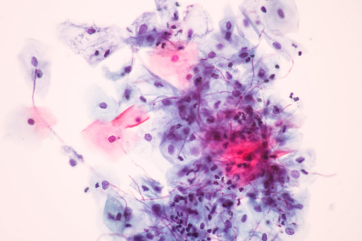 DARMPILZ (CANDIDA) VERTREIBEN: 3 TIPPS
